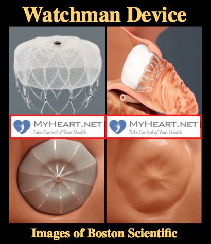 watchman device side effects