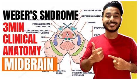 Weber Syndrome Midbrain Image