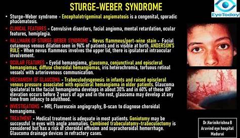 Weber Syndrome Symptoms Sturge . Causes, , Treatment Sturge