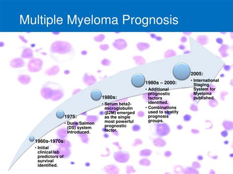 webmd multiple myeloma stages and prognosis