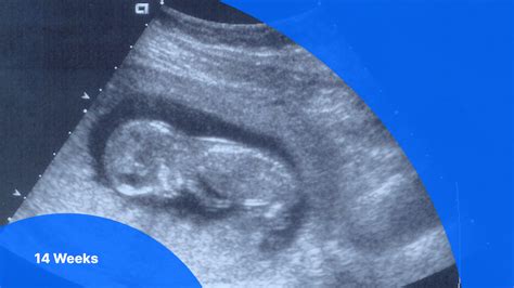 Your Baby at Week 14: Fetal Development Milestones and Pregnancy Insights