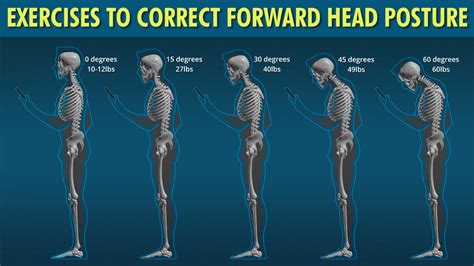 weight exercises for forward head posture