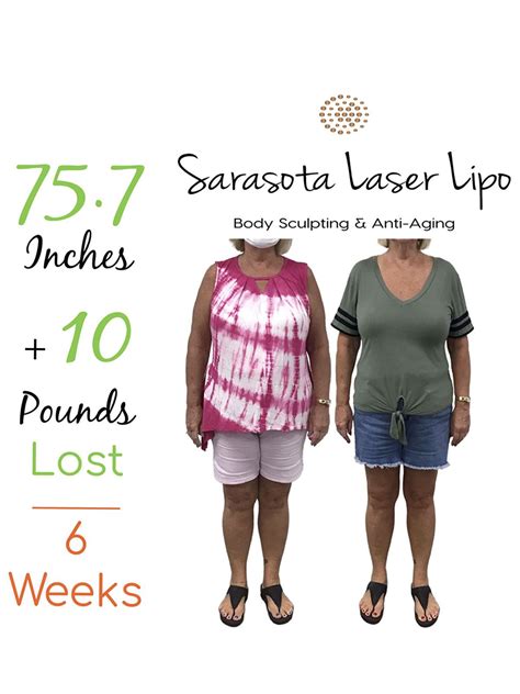 weight loss doctors in sarasota fl