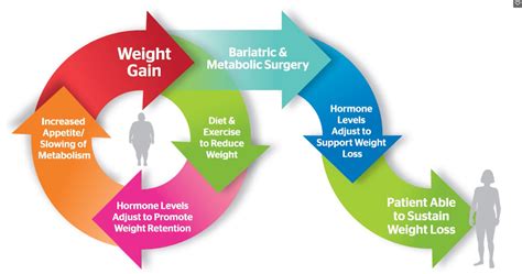 Weight Management Surgery