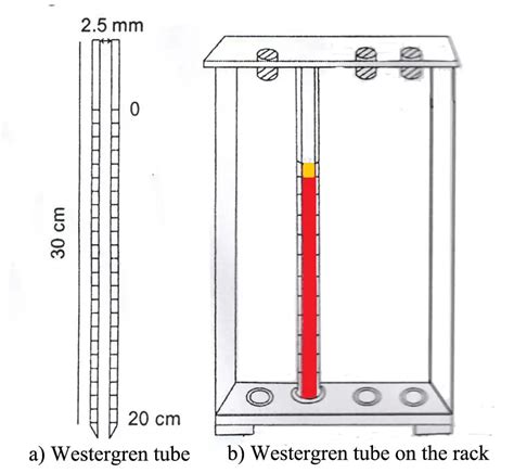 westergren esr method