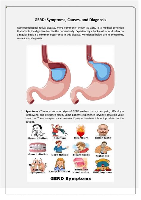 13 Gastroesophageal Reflux Disease (GERD) Warning Signs