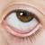 what color should the inside of your eyelid be