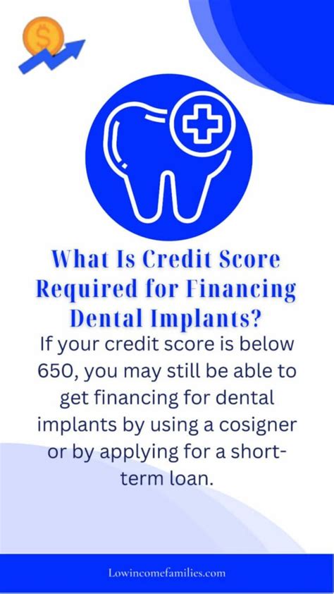 Simple Tips for Financing Dental Implants Midlothian, TX