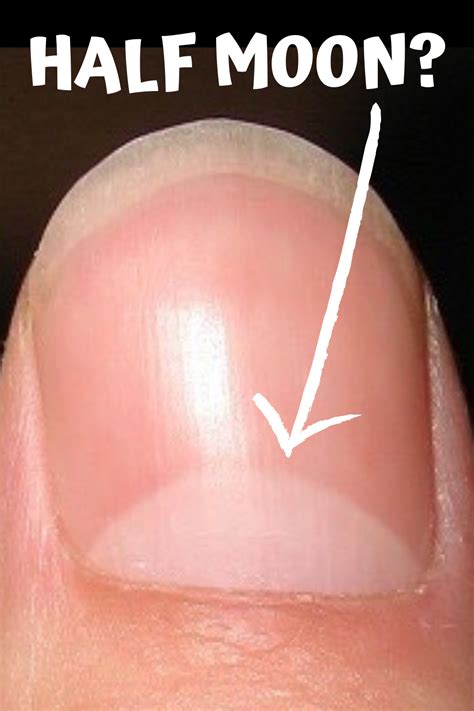 What Do Half Moons On Nails Indicate