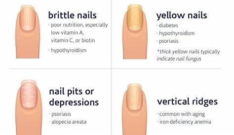 What Does Your Nail Color Say About You? by Nadine AbouLebde Musely