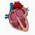 what does a left atrial enlargement mean