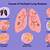 what does indeterminate lung nodules mean