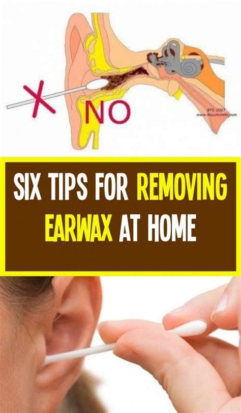 Six Tips Home to Remove Earwax Remove earwax, Removing earwax at home