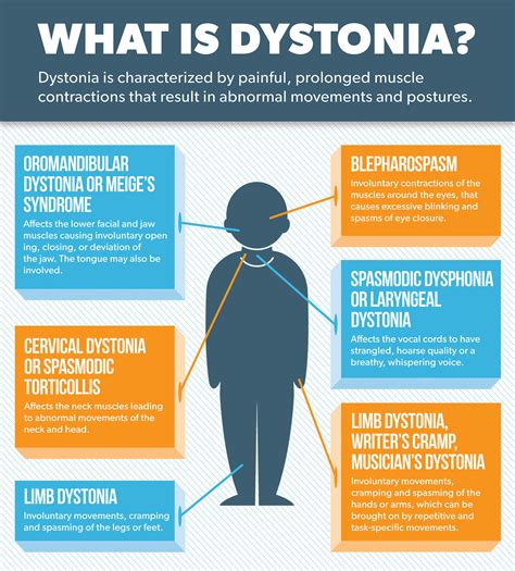 List Of What Is Dystonia Ideas