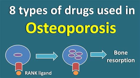 what is the best and safest treatment for osteoporosis 2022