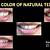 what is the natural color of teeth