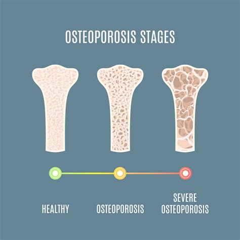 what is the pathophysiology of osteoporosis
