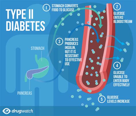 what is type 2 diabetes insulin