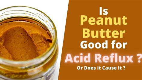 What Foods to Avoid if You Have Acid Reflux