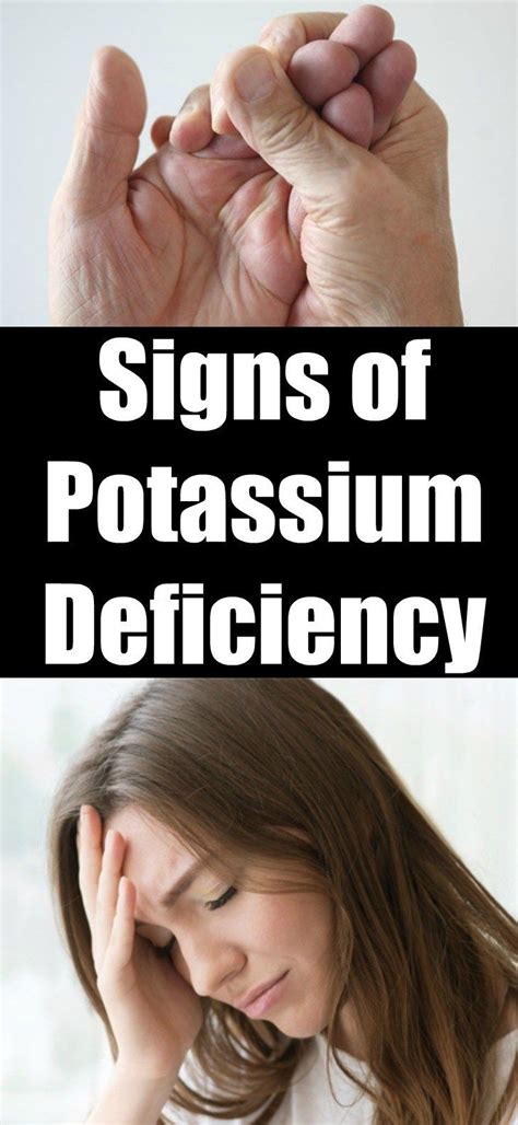6 signs you have a potassium deficiency YouTube