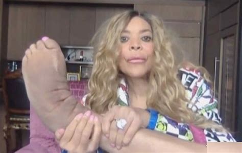 what's wrong with wendy williams feet