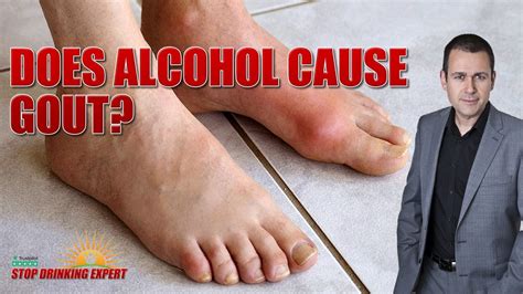 what alcohol won't cause gout
