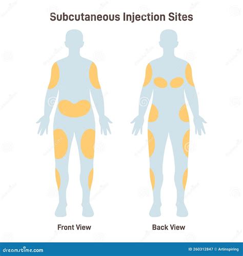 what are injection sites