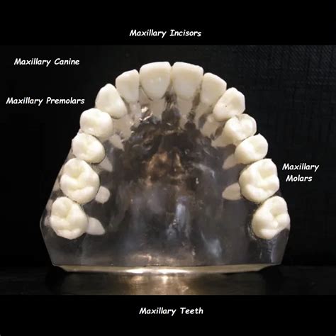 What Are Maxillary Teeth