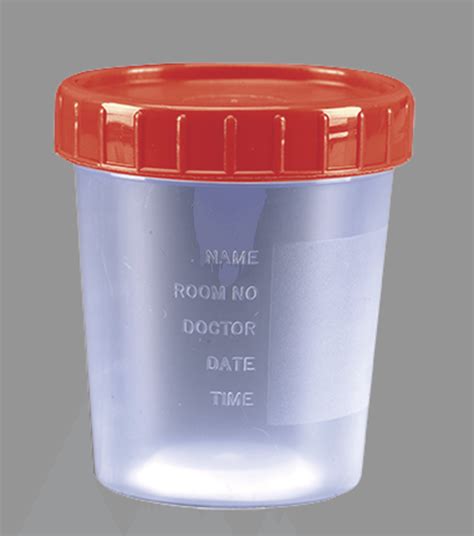 What Are Specimen Bottle