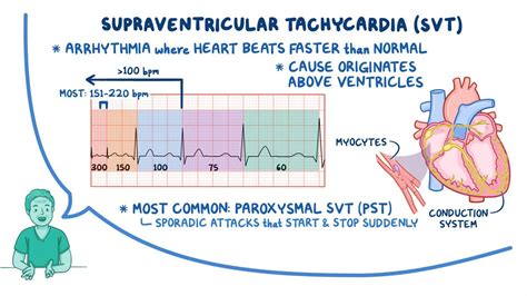 what are supraventricular arrhythmias