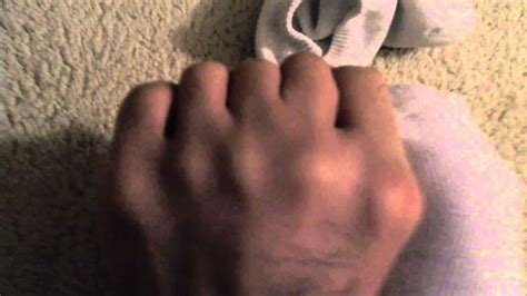 What Are Toe Knuckles