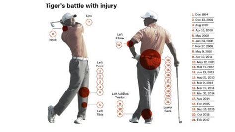 what back surgery did tiger woods have