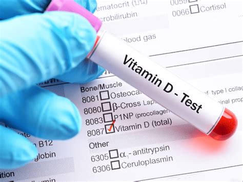 what blood test shows low vitamin d
