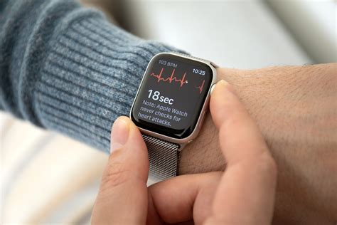  62 Most What Can Apple Watch Ecg Detect In 2023