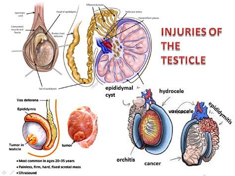 What Can Cause A Lump In Testicle