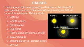 What Causes Halos Around Lights?
