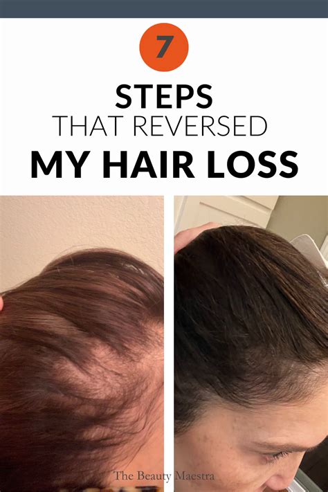 What Can I Take To Stop My Hair Thinning 