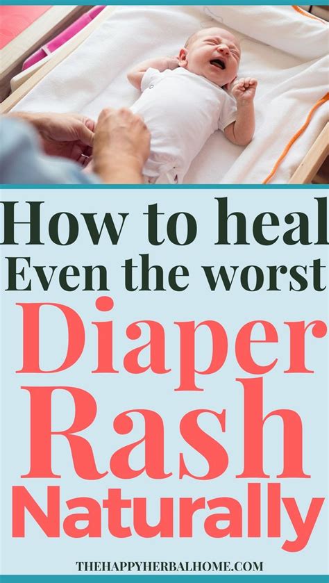 what can i use for my baby diaper rash