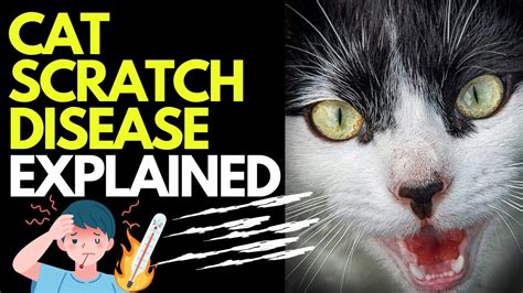 What Can U Get From A Cat Scratch
