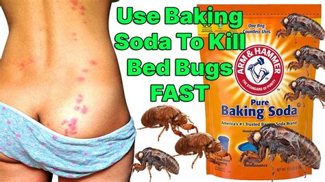 What Can You Use To Kill A Bed Bug