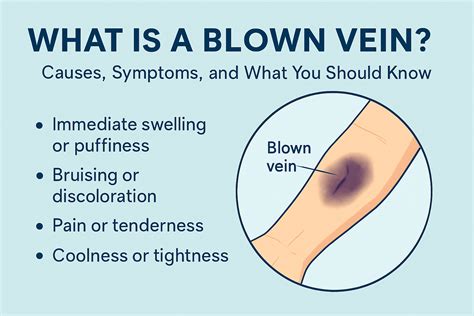 What Causes A Blown Rod