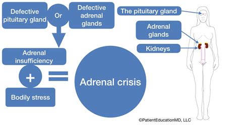 what causes adrenal gland failure