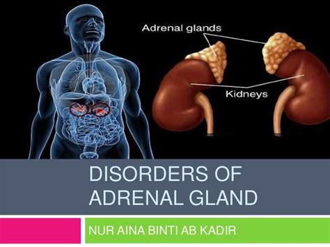 what causes adrenal gland problems