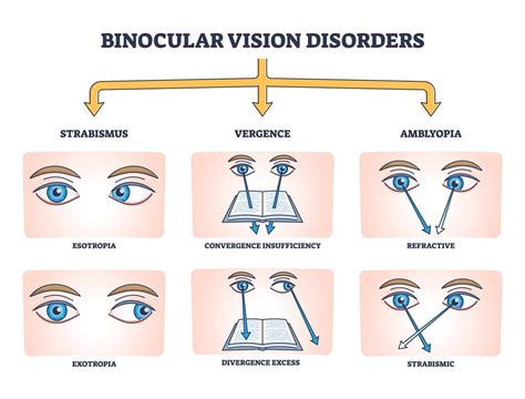 What Causes Binocular Vision