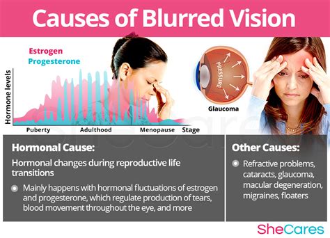 What Causes Blurry Side Vision