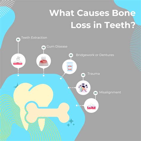 What Causes Bone Loss For Teeth