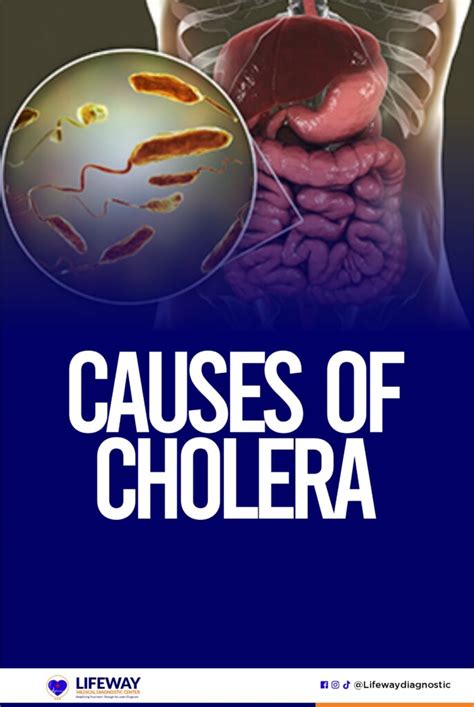 What Causes Cholera Outbreak