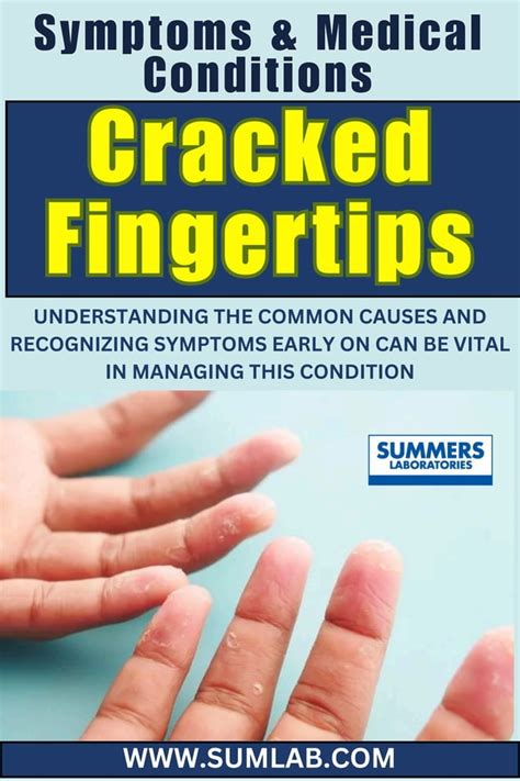 what causes cracked fingertips