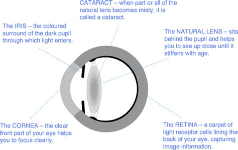 Best Eye Care Hospital in Chennai Lasik Eye Surgery