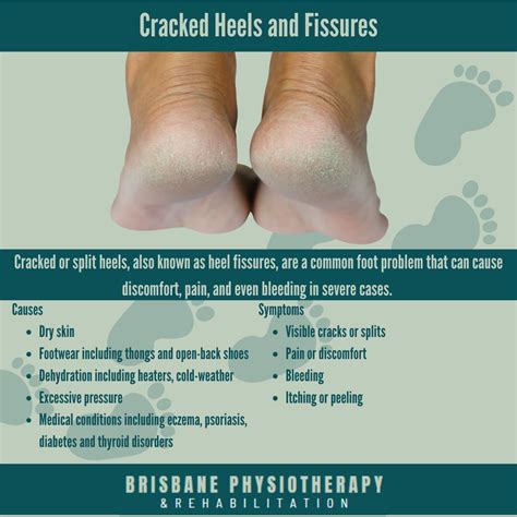 what causes heel cracks